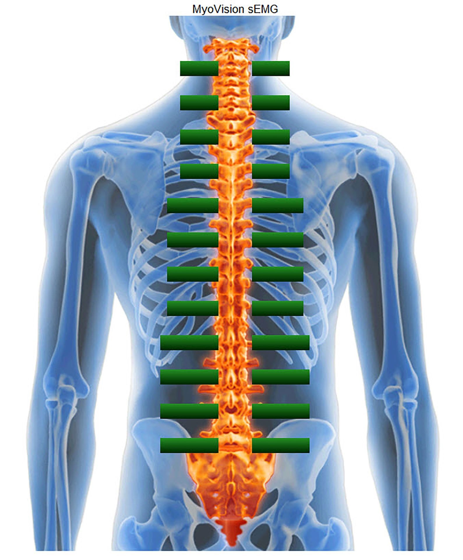 chiropractic myovision muscle scan  semg